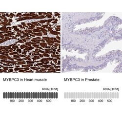 MyBPC3 Antibody, Novus Biologicals 0.1mL; Unlabeled:Antibodies, Polyclonal